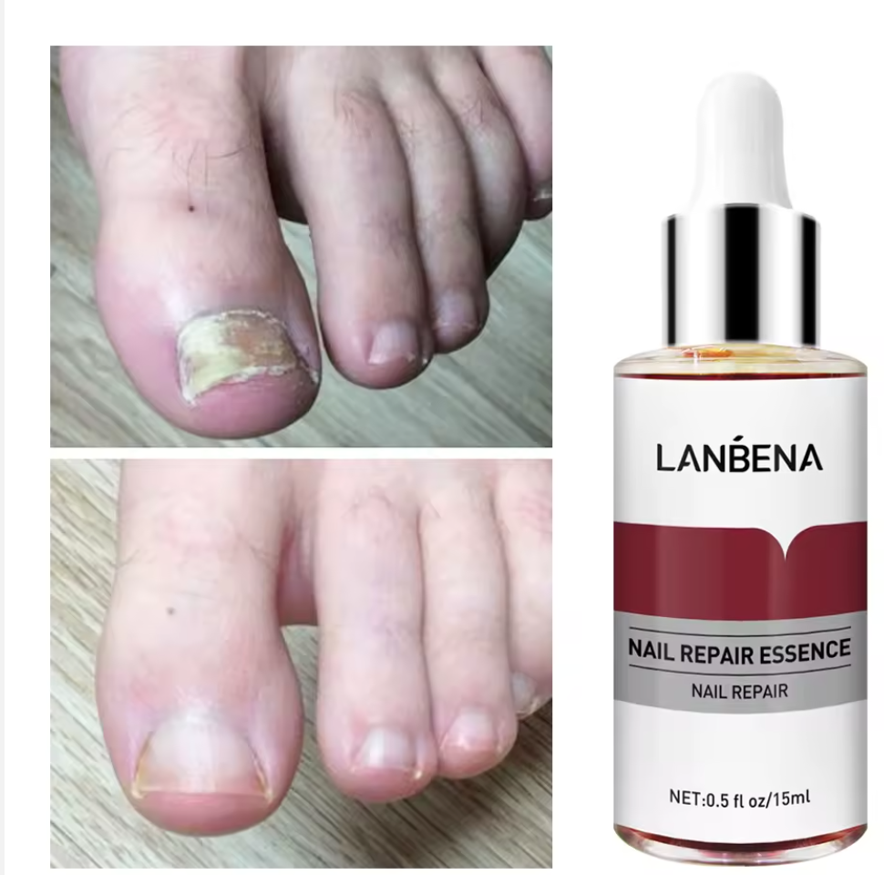 Antihongos para uñas